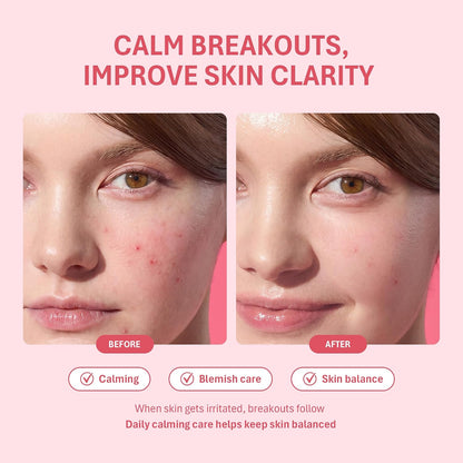Salicylic Acid Acne Spot Treatment for Face, 0.67 Fl.Oz.